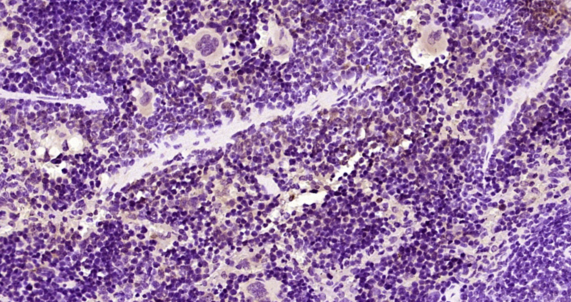 Paraformaldehyde-fixed, paraffin embedded Mouse spleen; Antigen retrieval by boiling in sodium citrate buffer (pH6.0) for 15min; Block endogenous peroxidase by 3% hydrogen peroxide for 20 minutes; Blocking buffer (normal goat serum) at 37°C for 30min; Antibody incubation with MSS1 Polyclonal Antibody, Unconjugated (bs-5120R) at 1:200 overnight at 4°C, DAB staining.