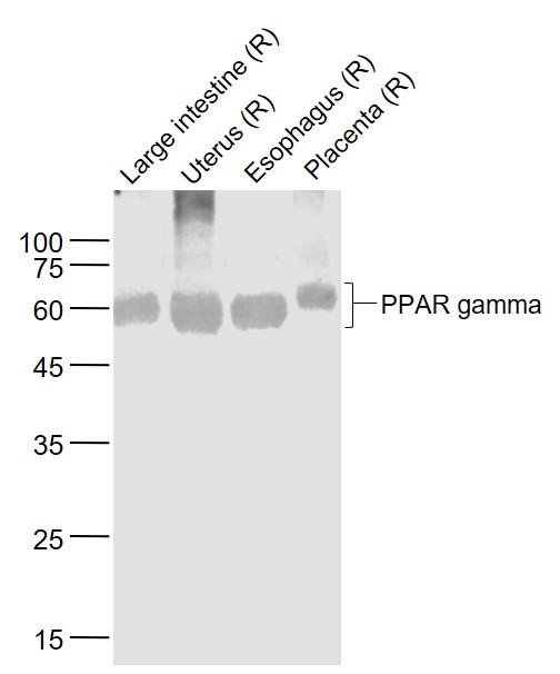 Lane 1: Rat Large intestine lysates; Lane 2: Rat Uterus lysates; Lane 3: Rat Esophagus lysates; Lane 4: Rat Placenta lysates probed with PPAR gamma Monoclonal Antibody, Unconjugated (bsm-52220R) at 1:1000 dilution and 4˚C overnight incubation. Followed by conjugated secondary antibody incubation at 1:20000 for 60 min at 37˚C.