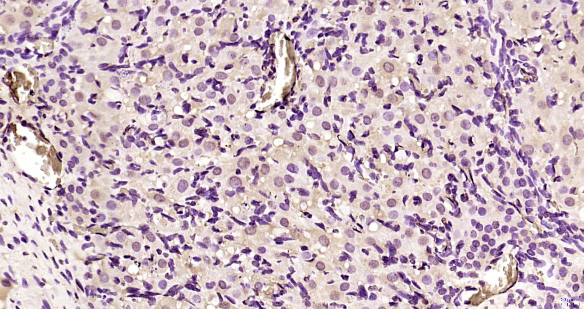 Paraformaldehyde-fixed, paraffin embedded Rat ovarian; Antigen retrieval by boiling in sodium citrate buffer (pH6.0) for 15min; Block endogenous peroxidase by 3% hydrogen peroxide for 20 minutes; Blocking buffer (normal goat serum) at 37°C for 30min; Antibody incubation with APC1 (Ser355) Polyclonal Antibody, Unconjugated (bs-5173R) at 1:200 overnight at 4°C, DAB staining.