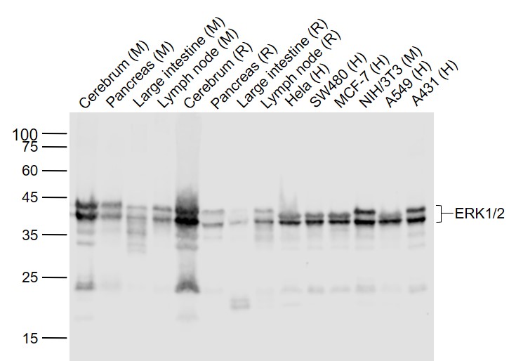Lane 1: Mouse Cerebrum lysates; Lane 2: Mouse Pancreas lysates; Lane 3: Mouse Large intestine lysates; Lane 4: Mouse Lymph node lysates; Lane 5: Rat Cerebrum lysates; Lane 6: Rat Pancreas lysates; Lane 7: Rat Large intestine lysates; Lane 8: Rat Lymph node lysates; Lane 9: Human Hela cell lysates; Lane 10: Human SW480 cell lysates; Lane 11: Human MCF-7 cell lysates; Lane 12: Mouse NIH/3T3 cell lysates; Lane 13: Human A549 cell lysates; Lane 14: Human A431 cell lysates probed with ERK1/2 (3A12) Monoclonal Antibody, Unconjugated (bsm-52259R) at 1:1000 dilution and 4˚C overnight incubation. Followed by conjugated secondary antibody incubation at 1:20000 for 60 min at 37˚C.