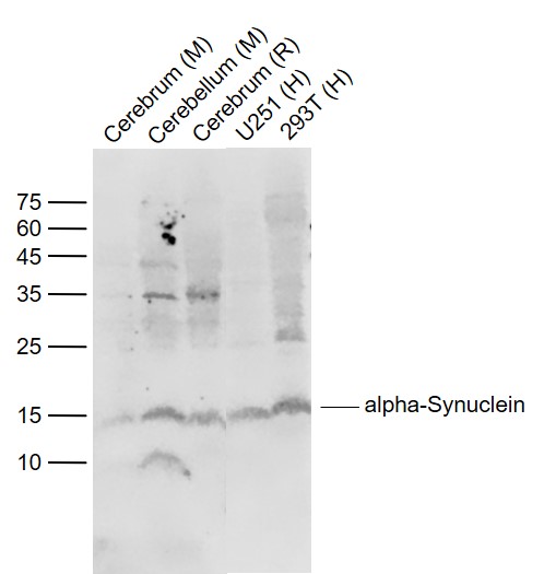 Lane 1: Mouse Cerebrum lysates; Lane 2: Mouse Cerebellum lysates; Lane 3: Rat Cerebrum lysates; Lane 4: Human U251 cell lysates; Lane 5: Human 293T cell lysates probed with alpha Synuclein Polyclonal Antibody, Unconjugated (bs-0009R) at 1:1000 dilution and 4˚C overnight incubation. Followed by conjugated secondary antibody incubation at 1:20000 for 60 min at 37˚C.
