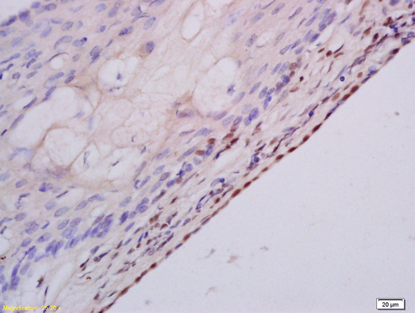 Formalin-fixed and paraffin embedded rat ovary labeled with Anti MSH3 Polyclonal Antibody, Unconjugated (bs-4919R) at 1:200 followed by conjugation to the secondary antibody and DAB staining Formalin-fixed and paraffin embedded rat ovary labeled with Anti MSH3 Polyclonal Antibody, Unconjugated (bs-4919R) at 1:200 followed by conjugation to the secondary antibody and DAB staining