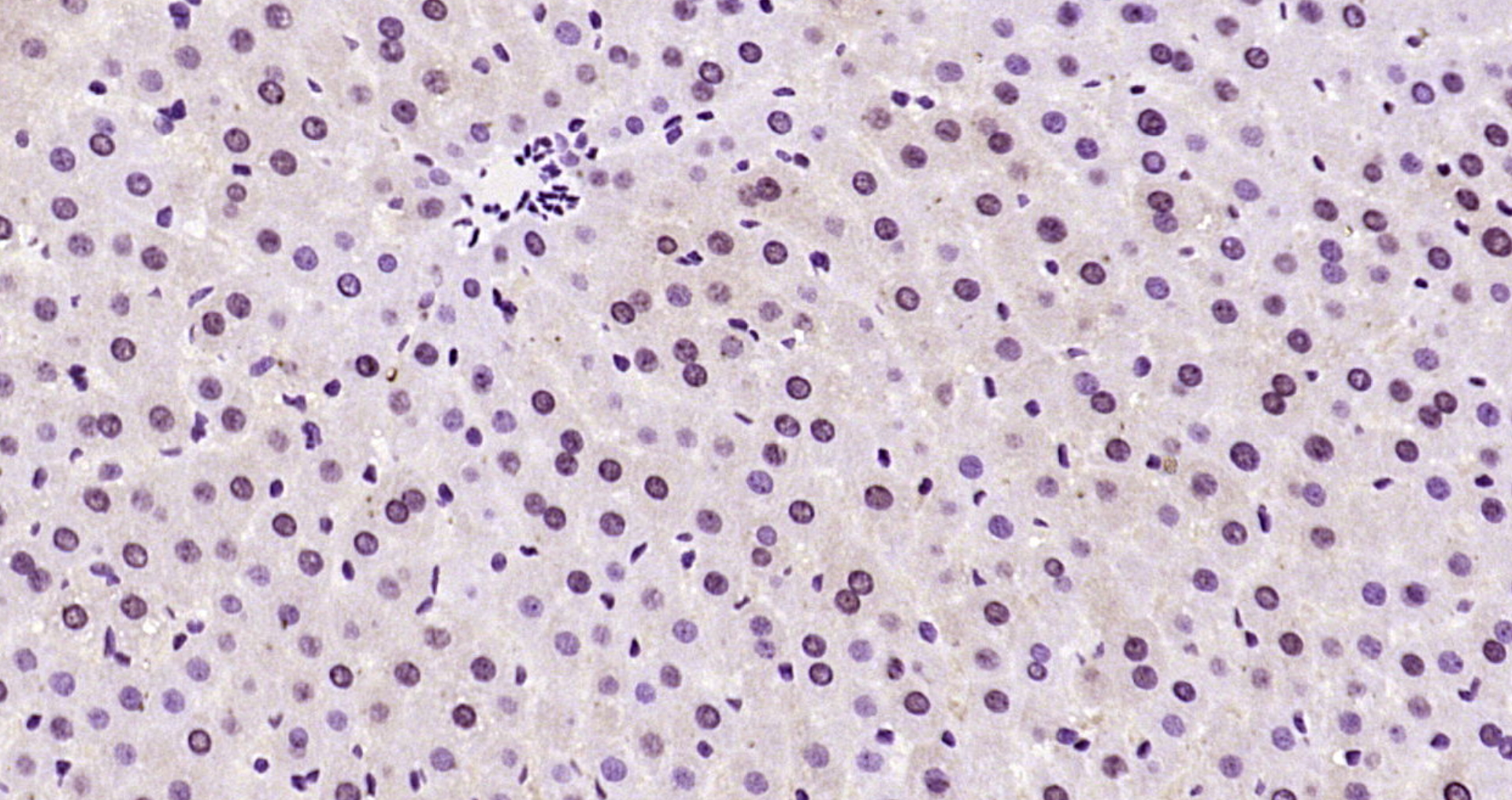 AMPK alpha 1 Thr198 Antibody Bioss