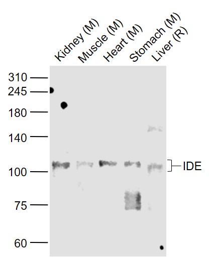 Lane 1: Mouse Kidney lysates; Lane 2: Mouse Muscle lysates; Lane 3: Mouse Heart lysates; Lane 4: Mouse Stomach lysates; Lane 5: Rat  Liver lysates probed with IDE Polyclonal  Antibody, Unconjugated (bs-0018R) at 1:1000 dilution and 4˚C overnight incubation. Followed by conjugated secondary antibody incubation at 1:20000 for 60 min at 37˚C.
