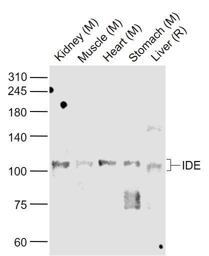 Lane 1: Mouse Kidney lysates; Lane 2: Mouse Muscle lysates; Lane 3: Mouse Heart lysates; Lane 4: Mouse Stomach lysates; Lane 5: Rat  Liver lysates probed with IDE Polyclonal  Antibody, Unconjugated (bs-0018R) at 1:1000 dilution and 4°C overnight incubation. Followed by conjugated secondary antibody incubation at 1:20000 for 60 min at 37°C.