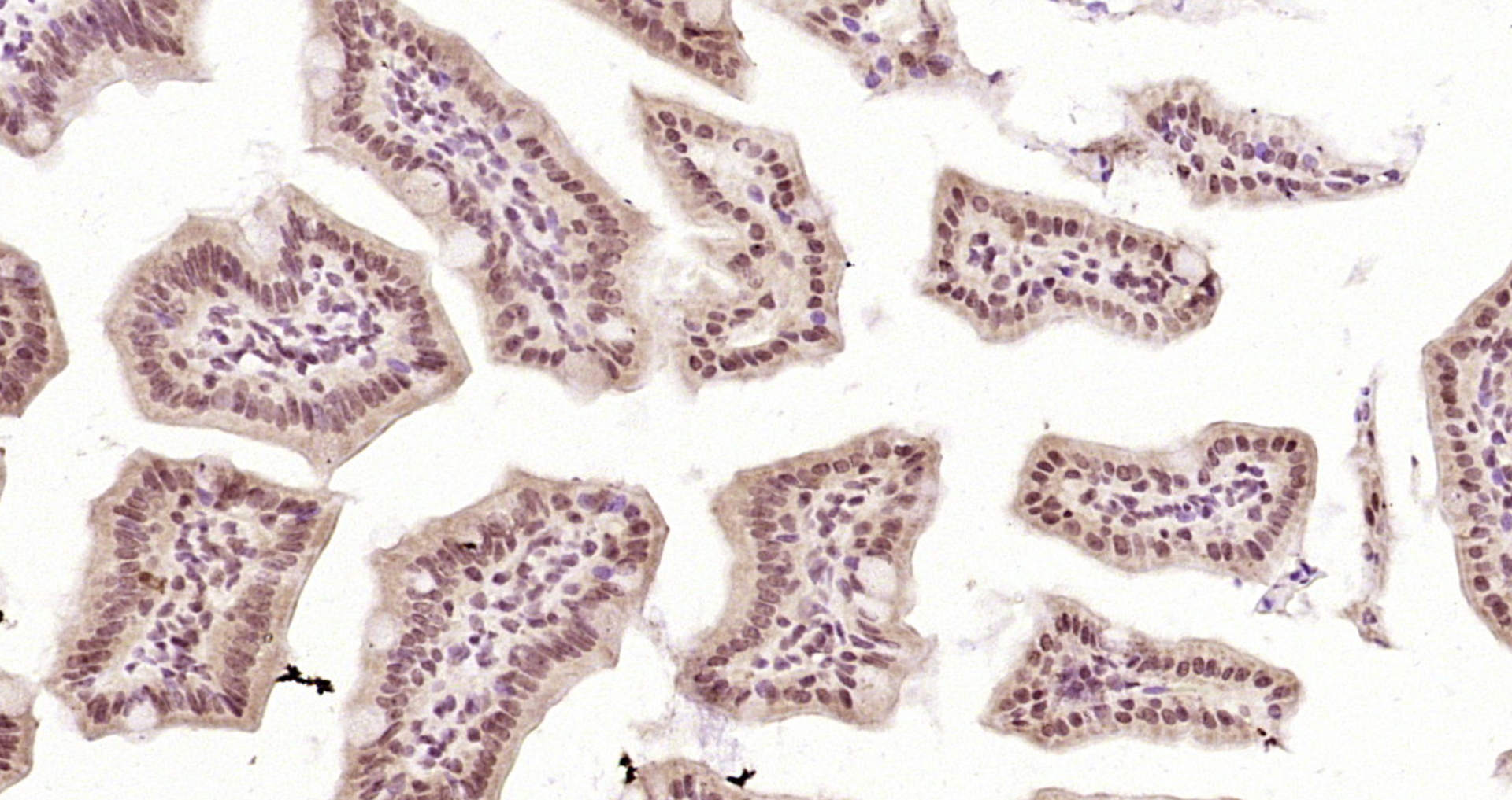 Paraformaldehyde-fixed, paraffin embedded Mouse intestine; Antigen retrieval by boiling in sodium citrate buffer (pH6.0) for 15min; Block endogenous peroxidase by 3% hydrogen peroxide for 20 minutes; Blocking buffer (normal goat serum) at 37°C for 30min; Antibody incubation with RPA2(Thr21) Polyclonal Antibody, Unconjugated (bs-5693R) at 1:200 overnight at 4°C, DAB staining.