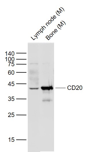 Lane 1: Mouse Lymph node lysates; Lane 2: Mouse Bone lysates probed with CD20 Polyclonal Antibody, Unconjugated (bs-0080R) at 1:1000 dilution and 4˚C overnight incubation. Followed by conjugated secondary antibody incubation at 1:20000 for 60 min at 37˚C.