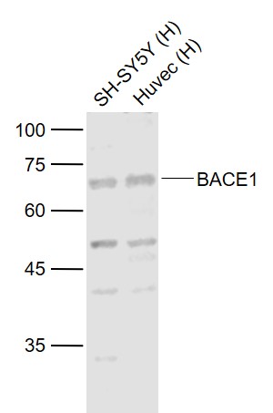 Lane 1: Human SH-SY5Y cell lysates; Lane 2: Human HUVEC cell lysates probed with BACE1 Polyclonal Antibody, Unconjugated (bs-0164R) at 1:1000 dilution and 4˚C overnight incubation. Followed by conjugated secondary antibody incubation at 1:20000 for 60 min at 37˚C.
