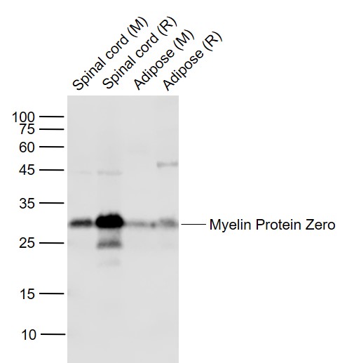 Lane 1: Mouse Spinal cordl lysates; Lane 2: Rat Spinal cord lysates; Lane 3: Mouse Adipose lysates; Lane 4: Rat Adipose lysates probed with Myelin Protein Zero Polyclonal Antibody, Unconjugated (bs-0337R) at 1:1000 dilution and 4˚C overnight incubation. Followed by conjugated secondary antibody incubation at 1:20000 for 60 min at 37˚C.