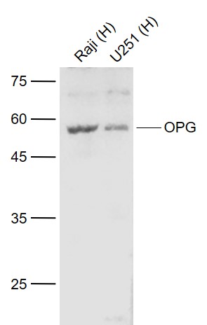 Lane 1: Human Raji cell lysates; Lane 2: Human U251 cell lysates probed with OPG Polyclonal Antibody, Unconjugated (bs-0431R) at 1:1000 dilution and 4˚C overnight incubation. Followed by conjugated secondary antibody incubation at 1:20000 for 60 min at 37˚C.