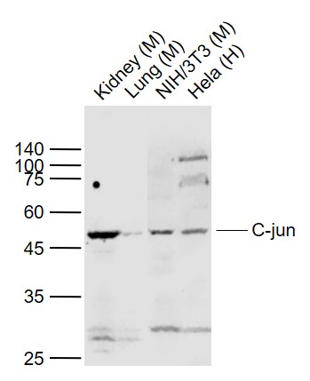 Lane 1: Mouse Kidney lysates; Lane 2: Mouse Lung lysates; Lane 3: Mouse NIH/3T3 cell lysates; Lane 4: Human Hela cell lysates probed with c-Jun Polyclonal Antibody, Unconjugated (bs-0670R) at 1:1000 dilution and 4˚C overnight incubation. Followed by conjugated secondary antibody incubation at 1:20000 for 60 min at 37˚C.