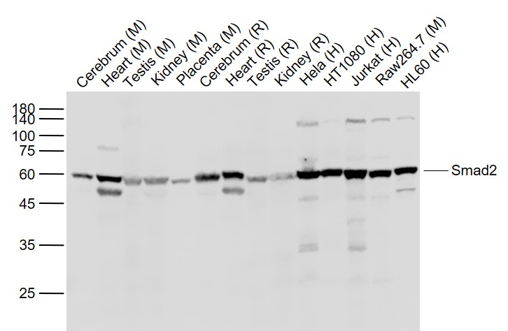 Lane 1: Mouse Cerebrum lysates; Lane 2: Mouse Heart lysates; Lane 3: Mouse Testis lysates; Lane 4: Mouse Kidney lysates; Lane 5: Mouse Placenta lysates; Lane 6: Rat Cerebrum lysates; Lane 7: Rat Heart lysates; Lane 8: Rat Testis lysates; Lane 9: Rat Kidney lysates; Lane 10: Human Hela cell lysates; Lane 11: Human HT1080 cell lysates; Lane 12: Human Jurkat cell lysates; Lane 13: Mouse RAW264.7 cell lysates; Lane 14: Human HL-60 cell lysates probed with Smad2 Polyclonal Antibody, Unconjugated (bs-0718R) at 1:1000 dilution and 4˚C overnight incubation. Followed by conjugated secondary antibody incubation at 1:20000 for 60 min at 37˚C.