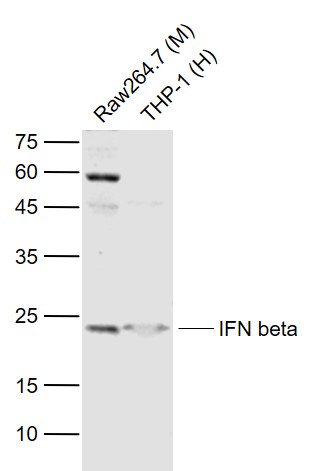 Lane 1: Mouse RAW264.7 cell lysates; Lane 2: Human THP-1 cell lysates probed with IFN-beta Polyclonal Antibody, Unconjugated (bs-0784R) at 1:1000 dilution and 4˚C overnight incubation. Followed by conjugated secondary antibody incubation at 1:20000 for 60 min at 37˚C.