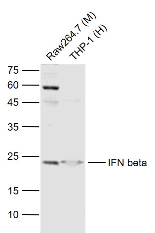 Lane 1: Mouse RAW264.7 cell lysates; Lane 2: Human THP-1 cell lysates probed with IFN-beta Polyclonal Antibody, Unconjugated (bs-0784R) at 1:1000 dilution and 4˚C overnight incubation. Followed by conjugated secondary antibody incubation at 1:20000 for 60 min at 37˚C. Lane 1: Mouse RAW264.7 cell lysates; Lane 2: Human THP-1 cell lysates probed with IFN-beta Polyclonal Antibody, Unconjugated (bs-0784R) at 1:1000 dilution and 4˚C overnight incubation. Followed by conjugated secondary antibody incubation at 1:20000 for 60 min at 37˚C.