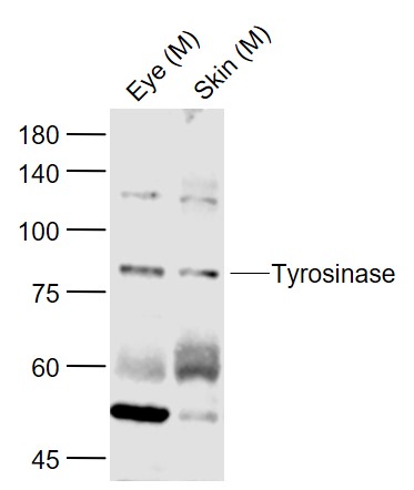 Lane 1: Mouse Eye lysates; Lane 2: Mouse Skin lysates probed with Tyrosinase Polyclonal  Antibody, Unconjugated (bs-0819R) at 1:1000 dilution and 4˚C overnight incubation. Followed by conjugated secondary antibody incubation at 1:20000 for 60 min at 37˚C.