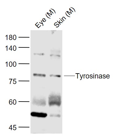 Lane 1: Mouse Eye lysates; Lane 2: Mouse Skin lysates probed with Tyrosinase Polyclonal Antibody, Unconjugated (bs-0819R) at 1:1000 dilution and 4˚C overnight incubation. Followed by conjugated secondary antibody incubation at 1:20000 for 60 min at 37˚C.