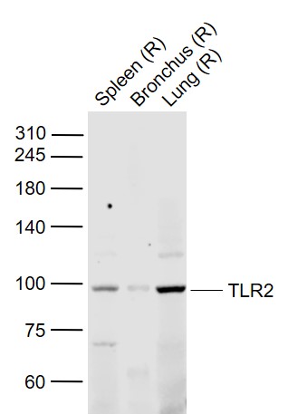 Lane 1: Rat Spleen lysates; Lane 2: Rat Bronchus lysates; Lane 3: Rat Lung lysates probed with TLR2 Polyclonal Antibody, Unconjugated (bs-1019R) at 1:1000 dilution and 4˚C overnight incubation. Followed by conjugated secondary antibody incubation at 1:20000 for 60 min at 37˚C.