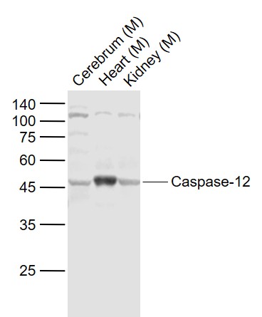 Lane 1: Mouse Cerebrum lysates; Lane 2: Mouse Heart lysates; Lane 3: Mouse Kidney lysates probed with Caspase 12 Polyclonal  Antibody, Unconjugated (bs-1105R) at 1:1000 dilution and 4˚C overnight incubation. Followed by conjugated secondary antibody incubation at 1:20000 for 60 min at 37˚C.