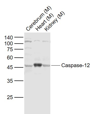 Lane 1: Mouse Cerebrum lysates; Lane 2: Mouse Heart lysates; Lane 3: Mouse Kidney lysates probed with Caspase 12 Polyclonal Antibody, Unconjugated (bs-1105R) at 1:1000 dilution and 4˚C overnight incubation. Followed by conjugated secondary antibody incubation at 1:20000 for 60 min at 37˚C.