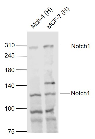 Lane 1: Human MOLT-4 cell lysates; Lane 2: Human MCF-7 cell lysates probed with Notch1/MOTC Polyclonal Antibody, Unconjugated (bs-1335R) at 1:1000 dilution and 4˚C overnight incubation. Followed by conjugated secondary antibody incubation at 1:20000 for 60 min at 37˚C.