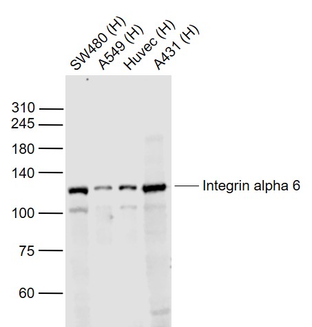 Lane 1: Human SW480 cell lysates; Lane 2: Human A549 cell lysates; Lane 3: Human HUVEC cell lysates; Lane 4: Human A431 cell lysates probed with Integrin alpha 6 Polyclonal Antibody, Unconjugated (bs-2641R) at 1:1000 dilution and 4˚C overnight incubation. Followed by conjugated secondary antibody incubation at 1:20000 for 60 min at 37˚C.