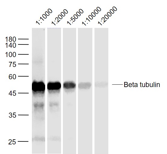 Cerebrum (Mouse) Lysate at 40 ug\r\nPrimary:\r\nAnti-Beta tubulin (bs-4511R) at 1\/1000~20000 dilution\r\nSecondary: IRDye800CW Goat Anti-Rabbit IgG at 1\/20000 dilution