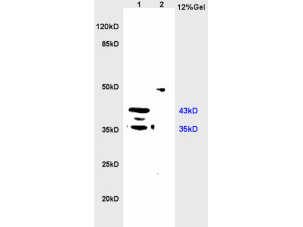 L1 rat kidney lysates L2 rat brain lysates probed with Anti MIIP Polyclonal Antibody, Unconjugated (bs-5842R) at 1:200 in 4˚C. Followed by conjugation to secondary antibody (bs-0295G-HRP) at 1:3000 90min in 37˚C. Predicted band 43kD. Observed band size: 35kD, 43kD L1 rat kidney lysates L2 rat brain lysates probed with Anti MIIP Polyclonal Antibody, Unconjugated (bs-5842R) at 1:200 in 4˚C. Followed by conjugation to secondary antibody (bs-0295G-HRP) at 1:3000 90min in 37˚C. Predicted band 43kD. Observed band size: 35kD, 43kD
