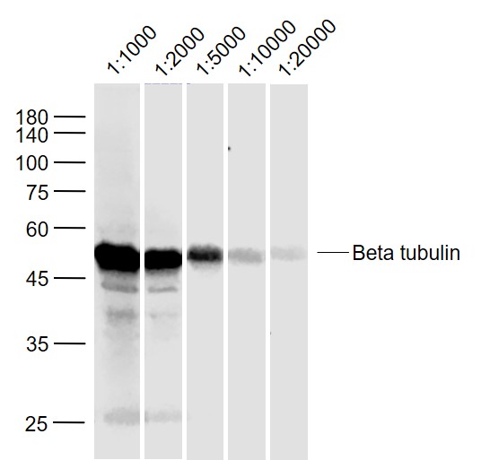 Sample:\r\nCerebrum (Rat) Lysate at 40 ug\r\nPrimary:\r\nAnti-Beta tubulin (bs-4511R) at 1\/1000~20000 dilution\r\nSecondary: IRDye800CW Goat Anti-Rabbit IgG at 1\/20000 dilution