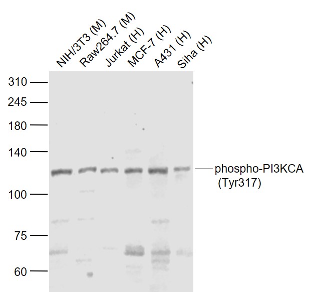 Lane 1: Mouse NIH/3T3 cell lysates; Lane 2: Mouse RAW264.7 cell lysates; Lane 3: Human Jurkat cell lysates; Lane 4: Human MCF-7 cell lysates; Lane 5: Human A431 cell lysates; Lane 6: Human Siha cell lysates probed with PI3KCA Polyclonal Antibody, Unconjugated (bs-5570R) at 1:1000 dilution and 4˚C overnight incubation. Followed by conjugated secondary antibody incubation at 1:20000 for 60 min at 37˚C.