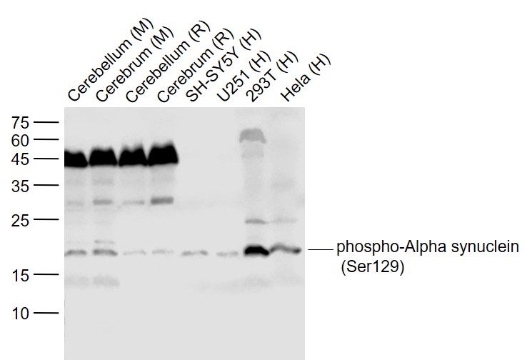 Lane 1: Mouse Cerebellum lysates; Lane 2: Mouse Cerebrum lysates; Lane 3: Rat Cerebellum lysates; Lane 4: Rat Cerebrum lysates; Lane 5: Human SH-SY5Y cell lysates; Lane 6: Human U251 cell lysates; Lane 7: Human 293T cell lysates; Lane 8: Human Hela cell lysates probed with Alpha synuclein Polyclonal Antibody, Unconjugated (bs-5628R) at 1:1000 dilution and 4˚C overnight incubation. Followed by conjugated secondary antibody incubation at 1:20000 for 60 min at 37˚C.