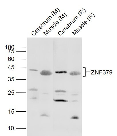 Lane 1: Mouse Cerebrum lysates; Lane 2: Mouse Muscle lysates; Lane 3: Rat Cerebrum lysates; Lane 4: Rat Muscle lysates probed with ZNF379 Polyclonal Antibody, Unconjugated (bs-6200R) at 1:1000 dilution and 4˚C overnight incubation. Followed by conjugated secondary antibody incubation at 1:20000 for 60 min at 37˚C.