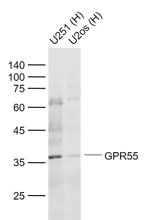 Lane 1: Human U251 cell lysates; Lane 2: Human U-2OS cell lysates probed with GPR55 Polyclonal Antibody, Unconjugated (bs-7686R) at 1:1000 dilution and 4˚C overnight incubation. Followed by conjugated secondary antibody incubation at 1:20000 for 60 min at 37˚C.