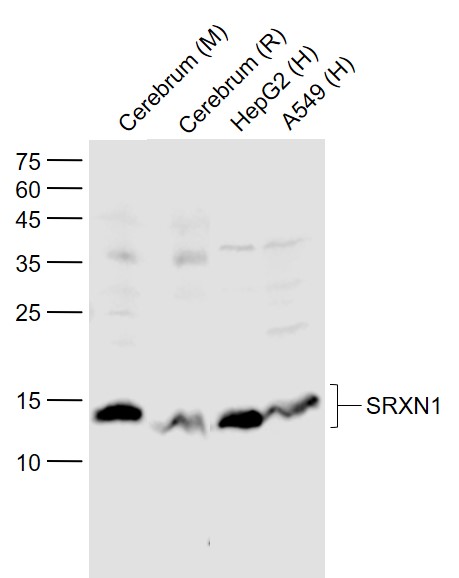 Lane 1: Mouse Cerebrum lysates; Lane 2: Rat Cerebrum lysates; Lane 3: Human HepG2 cell lysates; Lane 4: Human A549 cell lysates probed with SRXN1 Polyclonal Antibody, Unconjugated (bs-8329R) at 1:1000 dilution and 4˚C overnight incubation. Followed by conjugated secondary antibody incubation at 1:20000 for 60 min at 37˚C.