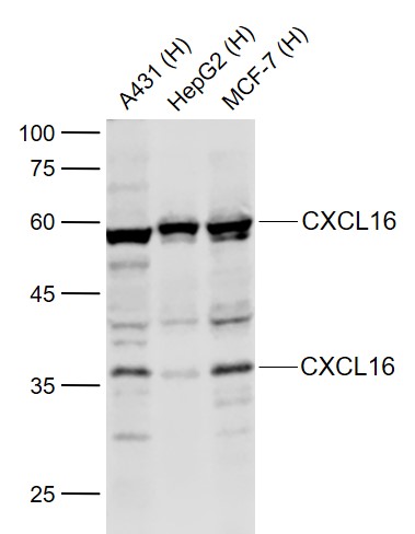 Lane 1: Human A431 cell lysates; Lane 2: Human HepG2 cell lysates; Lane 3: Human MCF-7 cell lysates probed with CXCL16 Polyclonal Antibody, Unconjugated (bs-8871R) at 1:1000 dilution and 4˚C overnight incubation. Followed by conjugated secondary antibody incubation at 1:20000 for 60 min at 37˚C.