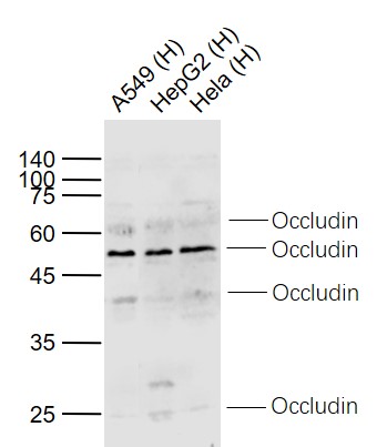 Lane 1: Human A549 cell lysates; Lane 2: Human HepG2 cell lysates; Lane 3: Human Hela cell lysates probed with Occludin Polyclonal Antibody, Unconjugated (bs-10011R) at 1:1000 dilution and 4˚C overnight incubation. Followed by conjugated secondary antibody incubation at 1:20000 for 60 min at 37˚C.