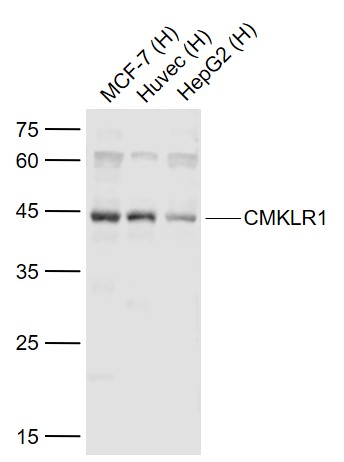 Lane 1: Human MCF-7 cell lysates; Lane 2: Human HUVEC cell lysates; Lane 3: Human HepG2 cell lysates probed with CMKLR1 Polyclonal Antibody, Unconjugated (bs-10183R) at 1:1000 dilution and 4˚C overnight incubation. Followed by conjugated secondary antibody incubation at 1:20000 for 60 min at 37˚C.