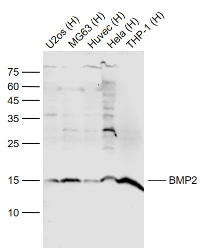 Lane 1: Human U-2OS cell lysates; Lane 2: Human MG63 cell lysates; Lane 3: Human HUVEC cell lysates; Lane 4: Human Hela cell lysates; Lane 5: Human THP-1 cell lysates probed with BMP2 Polyclonal Antibody, Unconjugated (bs-10696R) at 1:1000 dilution and 4˚C overnight incubation. Followed by conjugated secondary antibody incubation at 1:20000 for 60 min at 37˚C.