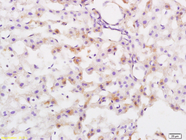 Formalin-fixed and paraffin embedded rat liver tissue labeled with Anti Protective Protein Polyclonal Antibody, Unconjugated (bs-6040R) at 1:200 followed by conjugation to the secondary antibody and DAB staining