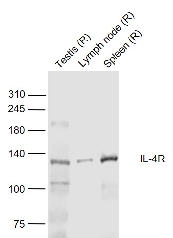 Lane 1: Rat Testis lysates; Lane 2: Rat Lymph node lysates; Lane 3: Rat Spleen lysates probed with IL-4R Polyclonal Antibody, Unconjugated (bs-23579R) at 1:1000 dilution and 4˚C overnight incubation. Followed by conjugated secondary antibody incubation at 1:20000 for 60 min at 37˚C.