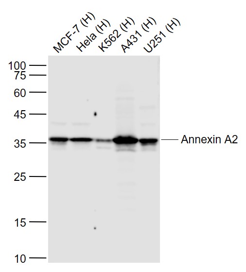 Lane 1: Human MCF-7 cell lysates; Lane 2: Human Hela cell lysates; Lane 3: Human K562 cell lysates; Lane 4: Human A431 cell lysates; Lane 5: Human U251 cell lysates probed with Annexin A2 Monoclonal Antibody, Unconjugated (bsm-54021R) at 1:1000 dilution and 4˚C overnight incubation. Followed by conjugated secondary antibody incubation at 1:20000 for 60 min at 37˚C.