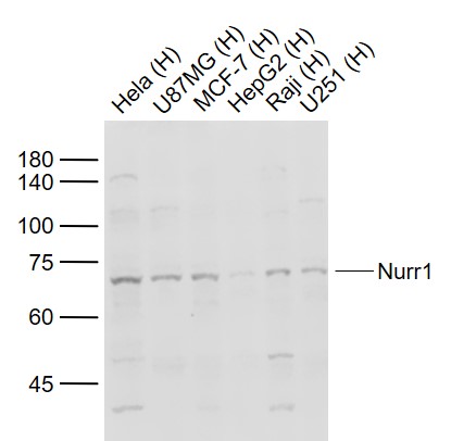 Lane 1: Human Hela cell lysates; Lane 2: Human U-87MG cell lysates; Lane 3: Human MCF-7 cell lysates; Lane 4: Human HepG2 cell lysates; Lane 5: Human Raji cell lysates; Lane 6: Human U251 cell lysates probed with Nurr1 Polyclonal Antibody, Unconjugated (bs-0178R) at 1:1000 dilution and 4˚C overnight incubation. Followed by conjugated secondary antibody incubation at 1:20000 for 60 min at 37˚C.