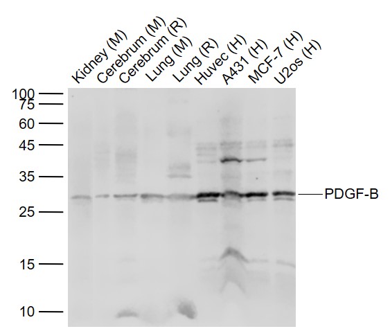 Lane 1: Mouse Kidney lysates; Lane 2: Mouse Cerebrum lysates; Lane 3: Rat Cerebrum lysates; Lane 4: Mouse Lung lysates; Lane 5: Rat Lung lysates; Lane 6: Human HUVEC cell lysates; Lane 7: Human A431 cell lysates; Lane 8: Human MCF-7 cell lysates; Lane 9: Human U-2OS cell lysates probed with PDGF B Polyclonal Antibody, Unconjugated (bs-0185R) at 1:1000 dilution and 4˚C overnight incubation. Followed by conjugated secondary antibody incubation at 1:20000 for 60 min at 37˚C.