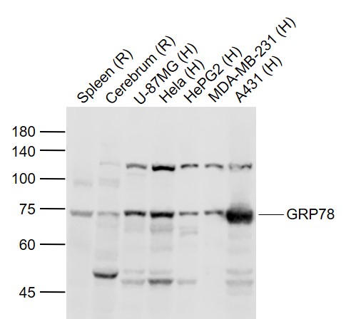 Lane 1: Rat Spleen lysates; Lane 2: Rat Cerebrum lysates; Lane 3: Human U-87MG cell lysates; Lane 4: Human Hela cell lysates; Lane 5: Human HepG2 cell lysates; Lane 6: Human MDA-MB-231 cell lysates; Lane 7: Human A431 cell lysates probed with GRP78 Polyclonal Antibody, Unconjugated (bs-1219R) at 1:1000 dilution and 4˚C overnight incubation. Followed by conjugated secondary antibody incubation at 1:20000 for 60 min at 37˚C.