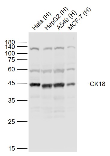 Lane 1: Human Hela cell lysates; Lane 2: Human HepG2 cell lysates; Lane 3: Human A549 cell lysates; Lane 4: Human MCF-7 cell lysates probed with CK18 Polyclonal Antibody, Unconjugated (bs-1339R) at 1:1000 dilution and 4˚C overnight incubation. Followed by conjugated secondary antibody incubation at 1:20000 for 60 min at 37˚C.