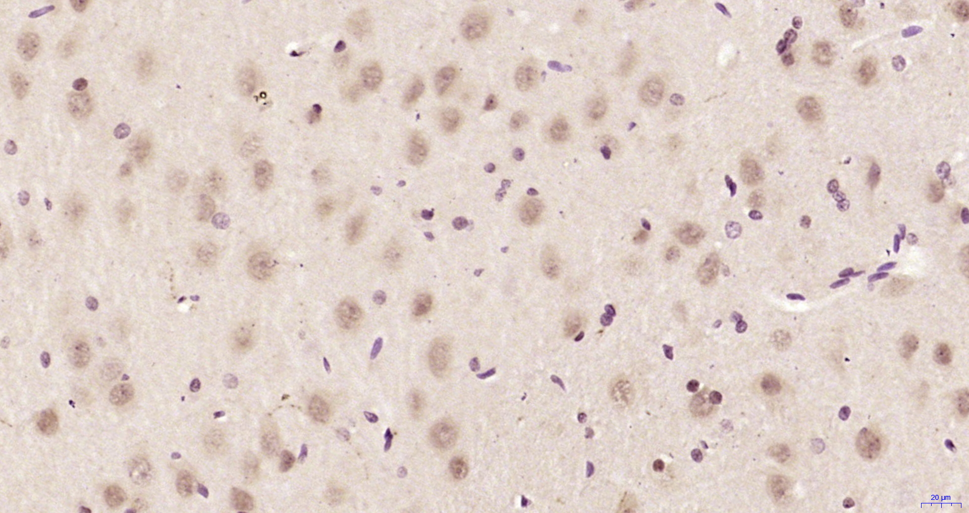 Paraformaldehyde-fixed, paraffin embedded Rat brain; Antigen retrieval by boiling in sodium citrate buffer (pH6.0) for 15min; Block endogenous peroxidase by 3% hydrogen peroxide for 20 minutes; Blocking buffer (normal goat serum) at 37°C for 30min; Antibody incubation with CCDC106 Polyclonal Antibody, Unconjugated (bs-5711R) at 1:200 overnight at 4°C, DAB staining.