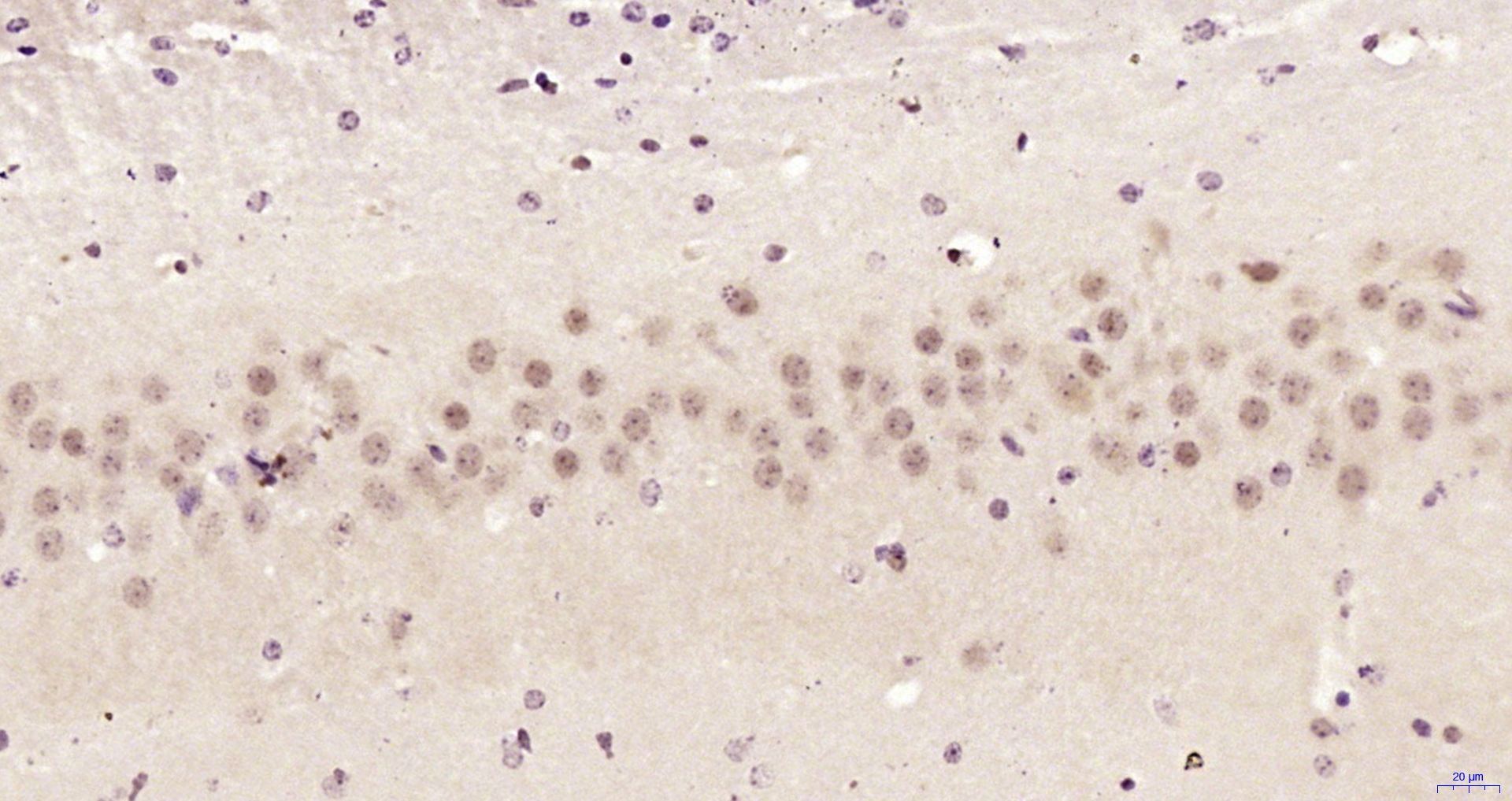 Paraformaldehyde-fixed, paraffin embedded Mouse brain; Antigen retrieval by boiling in sodium citrate buffer (pH6.0) for 15min; Block endogenous peroxidase by 3% hydrogen peroxide for 20 minutes; Blocking buffer (normal goat serum) at 37°C for 30min; Antibody incubation with CCDC106 Polyclonal Antibody, Unconjugated (bs-5711R) at 1:200 overnight at 4°C, DAB staining. Paraformaldehyde-fixed, paraffin embedded Mouse brain; Antigen retrieval by boiling in sodium citrate buffer (pH6.0) for 15min; Block endogenous peroxidase by 3% hydrogen peroxide for 20 minutes; Blocking buffer (normal goat serum) at 37°C for 30min; Antibody incubation with CCDC106 Polyclonal Antibody, Unconjugated (bs-5711R) at 1:200 overnight at 4°C, DAB staining.