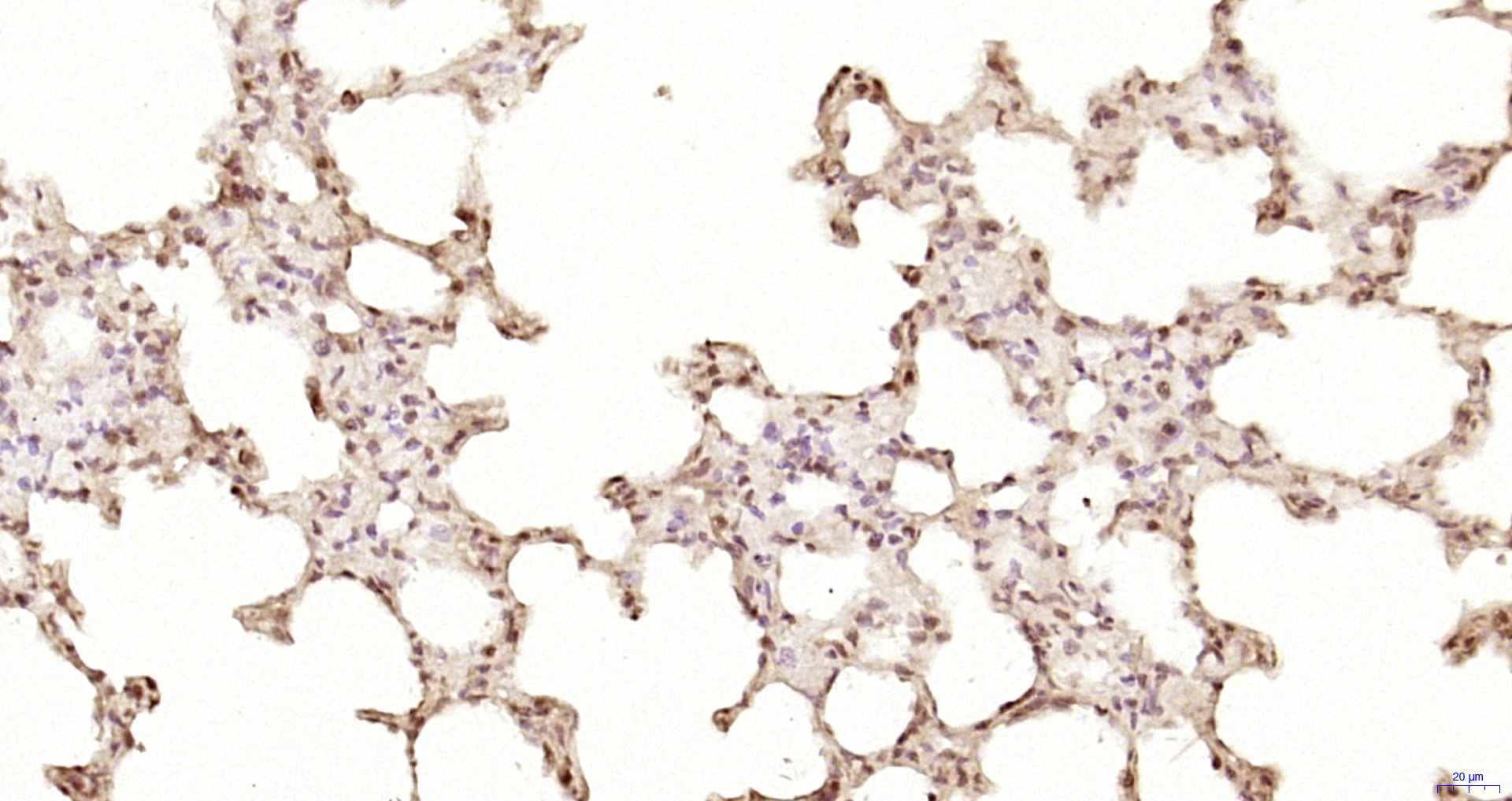 Paraformaldehyde-fixed, paraffin embedded Rat lung; Antigen retrieval by boiling in sodium citrate buffer (pH6.0) for 15min; Block endogenous peroxidase by 3% hydrogen peroxide for 20 minutes; Blocking buffer (normal goat serum) at 37°C for 30min; Antibody incubation with ZNF693 Polyclonal Antibody, Unconjugated (bs-5716R) at 1:200 overnight at 4°C, DAB staining.