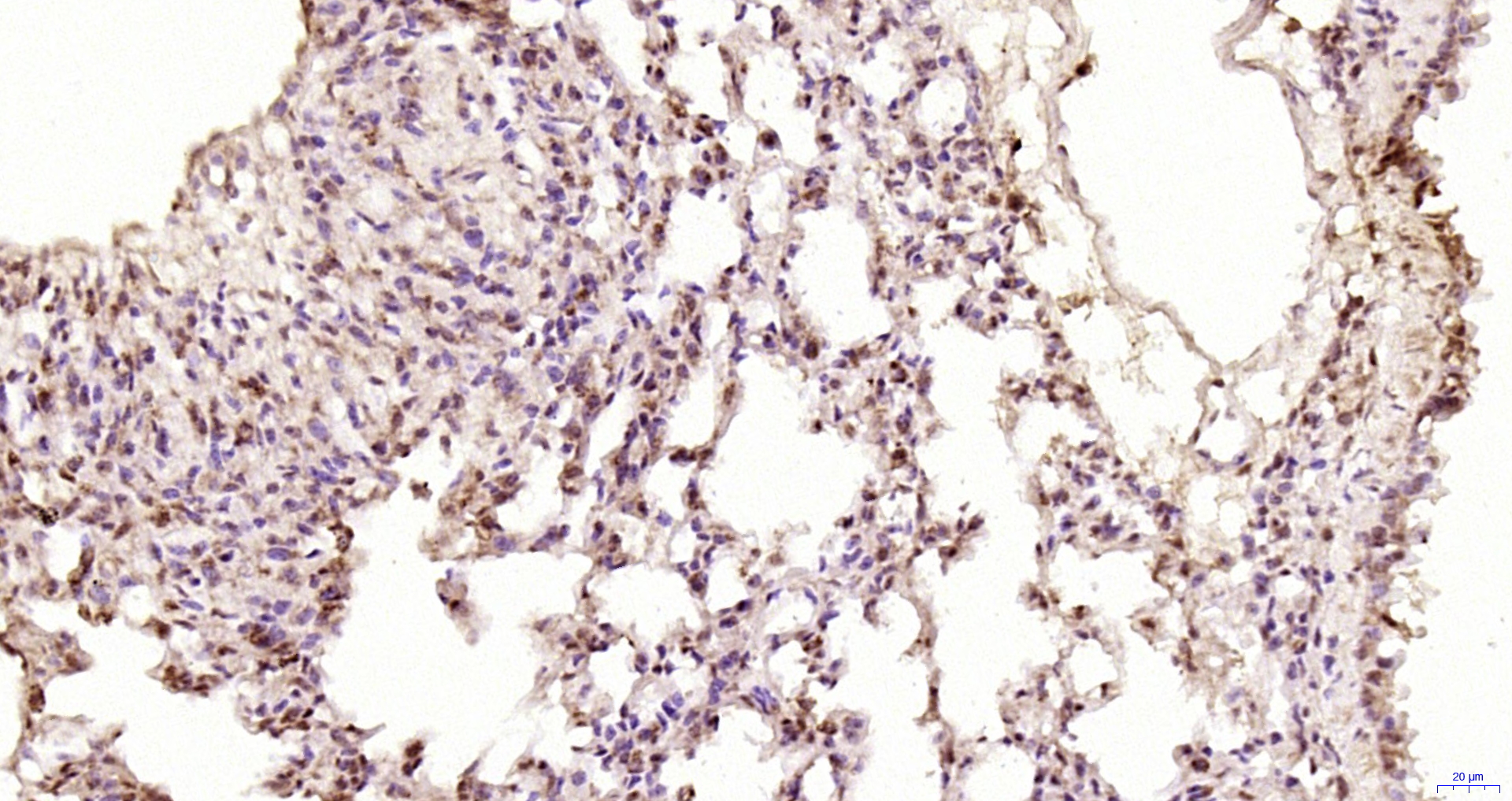 Paraformaldehyde-fixed, paraffin embedded Mouse lung; Antigen retrieval by boiling in sodium citrate buffer (pH6.0) for 15min; Block endogenous peroxidase by 3% hydrogen peroxide for 20 minutes; Blocking buffer (normal goat serum) at 37°C for 30min; Antibody incubation with ZNF693 Polyclonal Antibody, Unconjugated (bs-5716R) at 1:200 overnight at 4°C, DAB staining.