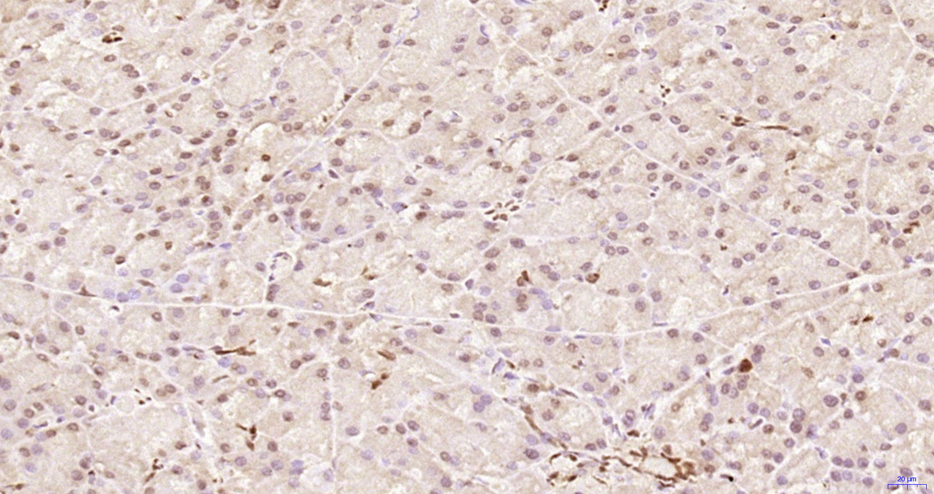 Paraformaldehyde-fixed, paraffin embedded Rat pancreas; Antigen retrieval by boiling in sodium citrate buffer (pH6.0) for 15min; Block endogenous peroxidase by 3% hydrogen peroxide for 20 minutes; Blocking buffer (normal goat serum) at 37°C for 30min; Antibody incubation with ZNF693 Polyclonal Antibody, Unconjugated (bs-5716R) at 1:200 overnight at 4°C, DAB staining.