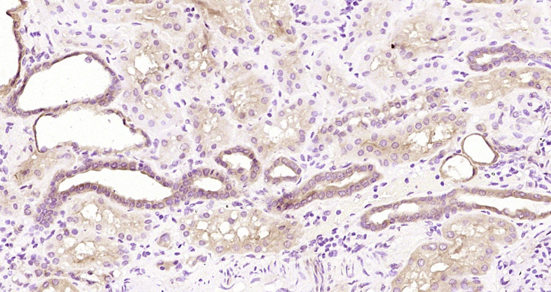 Paraformaldehyde-fixed, paraffin embedded Human kidney; Antigen retrieval by boiling in sodium citrate buffer (pH6.0) for 15min; Block endogenous peroxidase by 3% hydrogen peroxide for 20 minutes; Blocking buffer (normal goat serum) at 37°C for 30min; Antibody incubation with TACC2 Polyclonal Antibody, Unconjugated (bs-5736R) at 1:200 overnight at 4°C, DAB staining.
